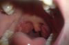Thumb_2c20e0fc-4e7a-4d46-995e-282e4ebf734a