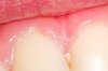 Thumb_3e6597d7-bdd3-4d00-9ac5-9831ca20cb14