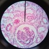 Thumb_6ca8728f-3e83-4fe1-9d1e-3febfbf7246d